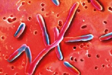 bactérie : Légionella